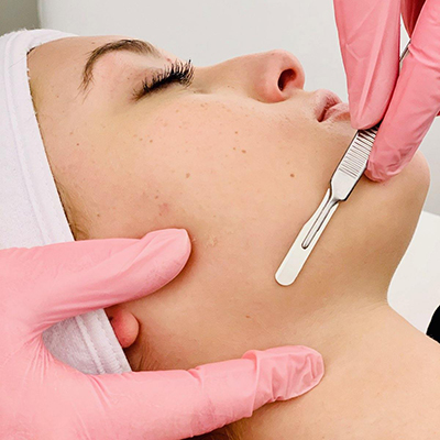 Dermaplaning Add-On